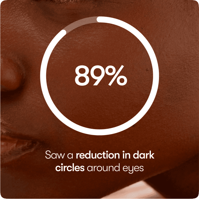 89% Saw a reduction in dark circles around eyes | Drowsy Sleep Supplements